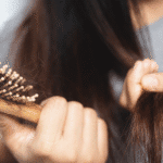 hair loss in women